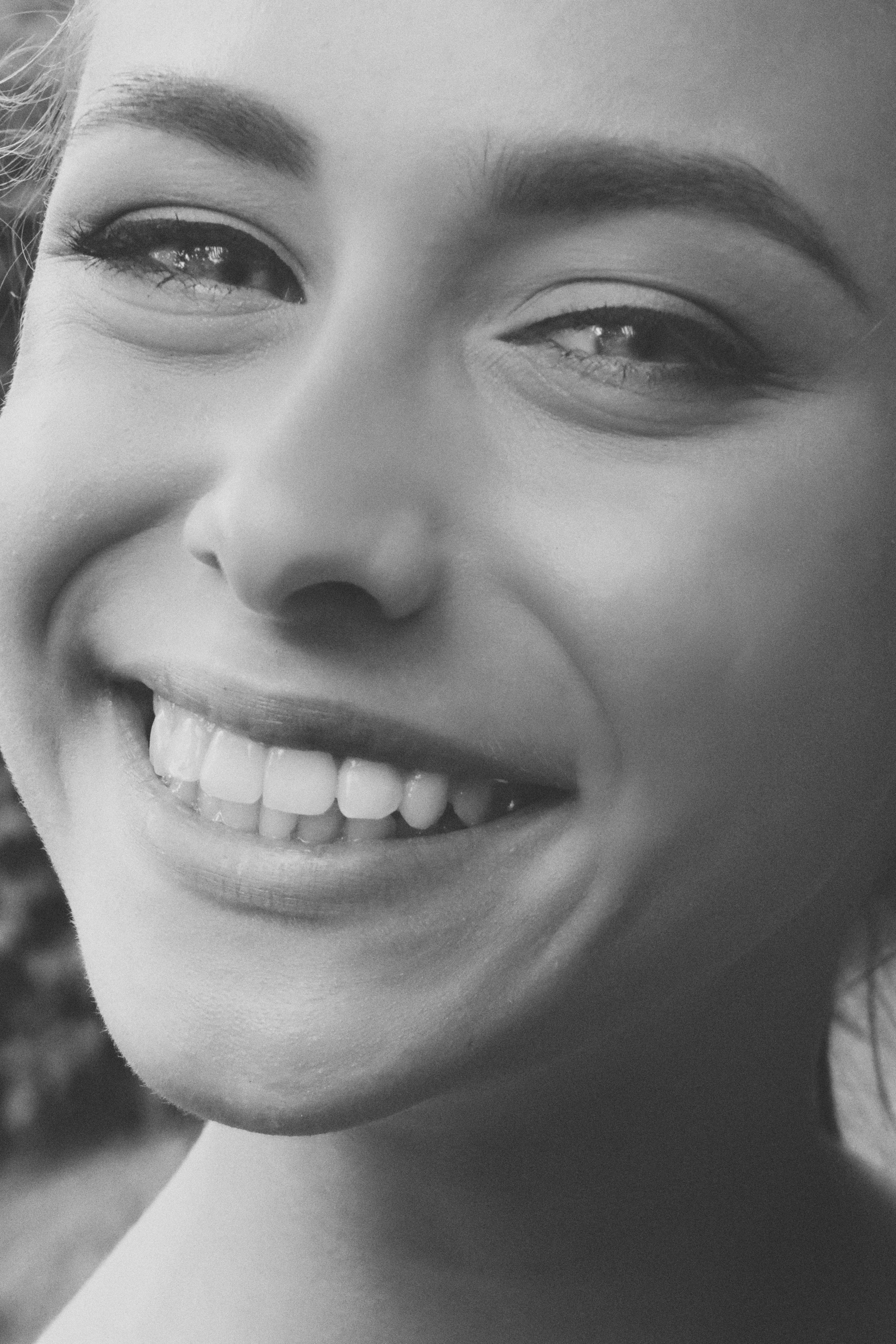 Dental Aligners and Braces at Zainee's Aesthetics